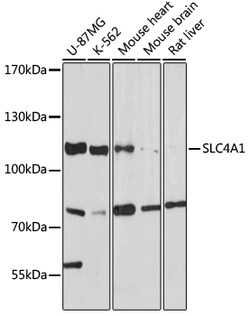 Invitrogen SLC4A1 Polyclonal Antibody 100 &mu;L; Unconjugated:Antibodies,
