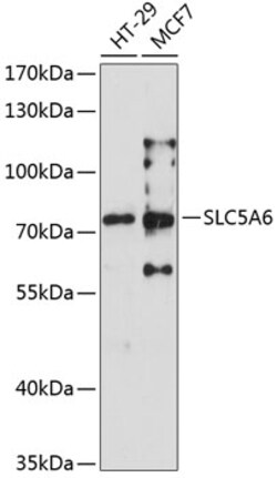 Invitrogen SLC5A6 Polyclonal Antibody 100 &mu;L; Unconjugated:Antibodies,