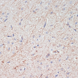 Invitrogen™ Dopamine Transporter Polyclonal Antibody
