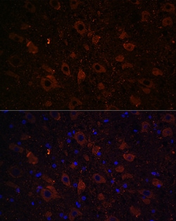Dopamine Transporter Polyclonal Antibody, Invitrogen 100 &mu;L; Unconjugated:Antibodies,