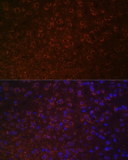 Dopamine Transporter Polyclonal Antibody, Invitrogen 100 &mu;L; Unconjugated:Antibodies,