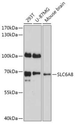Invitrogen SLC6A8 Polyclonal Antibody 100 &mu;L; Unconjugated:Antibodies,