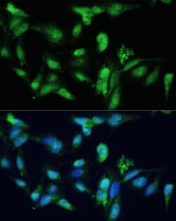SMAD2/SMAD3 Rabbit anti-Human, Unconjugated, Polyclonal, Invitrogen 100