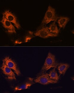 Invitrogen SMAP1 Polyclonal Antibody 100 μL; Unconjugated:Antibodies,