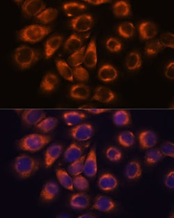 Invitrogen SMAP1 Polyclonal Antibody 100 μL; Unconjugated:Antibodies,