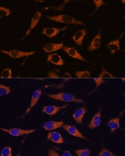 Invitrogen SMAP1 Polyclonal Antibody 100 μL; Unconjugated:Antibodies,