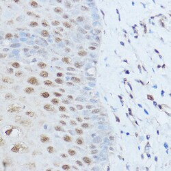 Invitrogen SMARCD2 Polyclonal Antibody 100 &mu;L | Buy Online | Invitrogen&trade; | Fisher Scientific