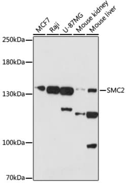 Invitrogen SMC2 Polyclonal Antibody 100 &mu;L; Unconjugated:Antibodies,