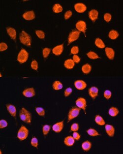 Invitrogen SMPD4 Polyclonal Antibody 100 &mu;L; Unconjugated:Antibodies,