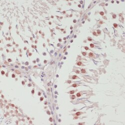 Invitrogen SNRNP70 Polyclonal Antibody 100 &mu;L; Unconjugated:Antibodies,
