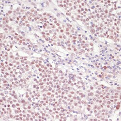 Invitrogen SNRNP70 Polyclonal Antibody 100 &mu;L; Unconjugated:Antibodies,
