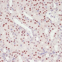 Invitrogen SNRNP70 Polyclonal Antibody 100 &mu;L; Unconjugated:Antibodies,
