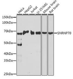 Invitrogen SNRNP70 Polyclonal Antibody 100 &mu;L; Unconjugated:Antibodies,