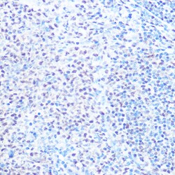 Invitrogen SNRPB Polyclonal Antibody 100 μL; Unconjugated:Antibodies,
