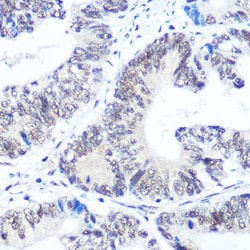 Invitrogen SNRPB Polyclonal Antibody 100 μL; Unconjugated:Antibodies,