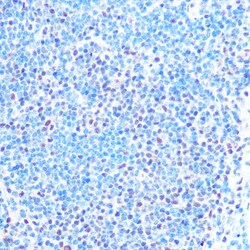 Invitrogen SNRPB Polyclonal Antibody 100 μL; Unconjugated:Antibodies,