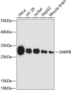 Invitrogen SNRPB Polyclonal Antibody 100 μL; Unconjugated:Antibodies,