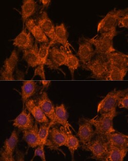 Invitrogen SNX15 Polyclonal Antibody 100 μL; Unconjugated:Antibodies,