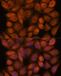 Invitrogen SNX15 Polyclonal Antibody 100 μL; Unconjugated:Antibodies,