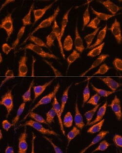 Invitrogen SNX15 Polyclonal Antibody 100 μL; Unconjugated:Antibodies,