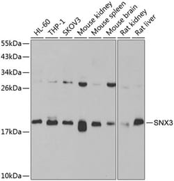 SNX3 Polyclonal Antibody:Antibodies, Polyclonal