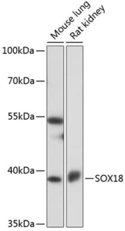 Invitrogen SOX18 Polyclonal Antibody 100 &mu;L | Buy Online | Invitrogen&trade; | Fisher Scientific