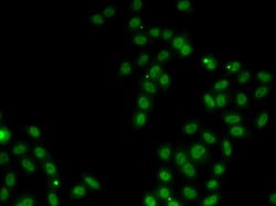 Invitrogen SOX5 Polyclonal Antibody 100 μL; Unconjugated:Antibodies,
