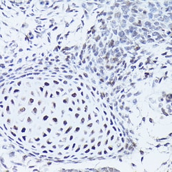 Invitrogen SOX5 Polyclonal Antibody 100 μL; Unconjugated:Antibodies,