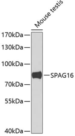 Invitrogen SPAG16 Polyclonal Antibody 100 &mu;L | Buy Online | Invitrogen&trade; | Fisher Scientific