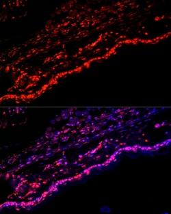 Invitrogen SPRR1A Polyclonal Antibody 100 &mu;L; Unconjugated:Antibodies,
