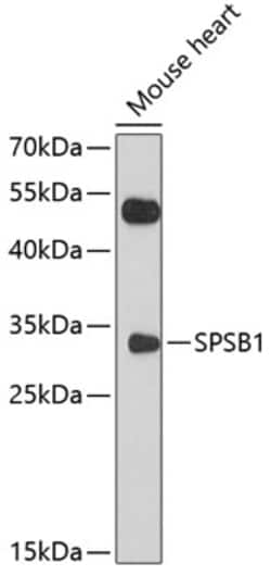 Invitrogen SPSB1 Polyclonal Antibody 100 &mu;L; Unconjugated:Antibodies,