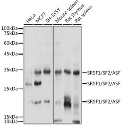 Invitrogen SRSF1 Polyclonal Antibody 100 &mu;L | Buy Online | Invitrogen&trade; | Fisher Scientific