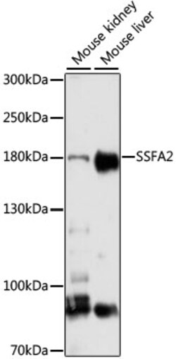 Invitrogen SSFA2 Polyclonal Antibody 100 μL; Unconjugated:Antibodies,