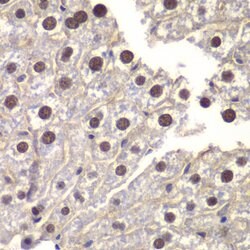 ST14 Polyclonal Antibody, Invitrogen 100 &mu;L; Unconjugated:Antibodies,