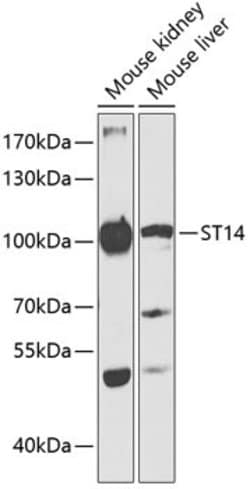 ST14 Polyclonal Antibody, Invitrogen 100 &mu;L; Unconjugated:Antibodies,