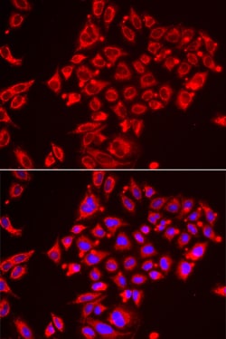 Invitrogen ST3GAL3 Polyclonal Antibody 100 &mu;L; Unconjugated:Antibodies,