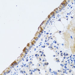 Invitrogen ST3GAL3 Polyclonal Antibody 100 &mu;L; Unconjugated:Antibodies,