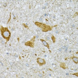 Invitrogen ST3GAL3 Polyclonal Antibody 100 &mu;L; Unconjugated:Antibodies,