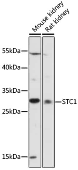 Invitrogen STC1 Polyclonal Antibody 100 &mu;L; Unconjugated:Antibodies,
