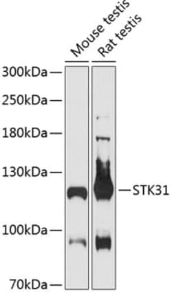 Invitrogen STK31 Polyclonal Antibody 100 &mu;L; Unconjugated:Antibodies,