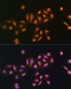 Invitrogen STK38 Polyclonal Antibody 100 &mu;L; Unconjugated:Antibodies,