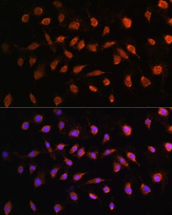 Invitrogen STK38 Polyclonal Antibody 100 &mu;L; Unconjugated:Antibodies,