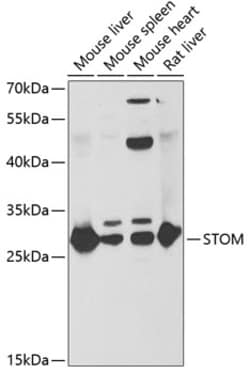 Invitrogen STOM Polyclonal Antibody 100 &mu;L; Unconjugated:Antibodies,