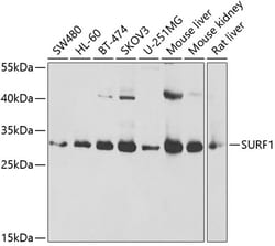 Invitrogen SURF1 Polyclonal Antibody 100 &mu;L; Unconjugated:Antibodies,