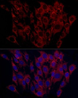 Invitrogen SURF4 Polyclonal Antibody 100 &mu;L; Unconjugated:Antibodies,