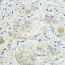 Invitrogen SURF4 Polyclonal Antibody 100 &mu;L; Unconjugated:Antibodies,