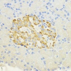 Invitrogen SURF4 Polyclonal Antibody 100 &mu;L; Unconjugated:Antibodies,