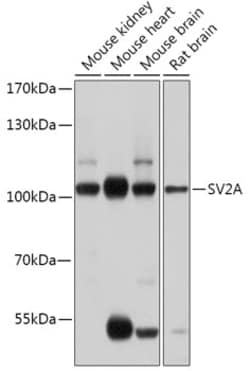 Invitrogen SV2A Polyclonal Antibody 100 &mu;L; Unconjugated:Antibodies,