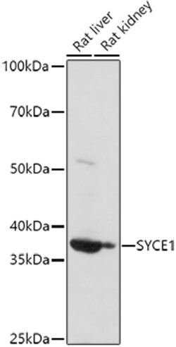 Invitrogen SYCE1 Polyclonal Antibody 100 &mu;L; Unconjugated:Antibodies,