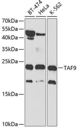 Invitrogen TAF9 Polyclonal Antibody 100 &mu;L; Unconjugated:Antibodies,